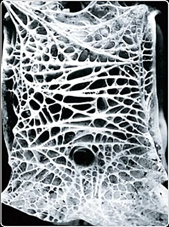 Microscopic image of trabecular bone's natural lattice structure