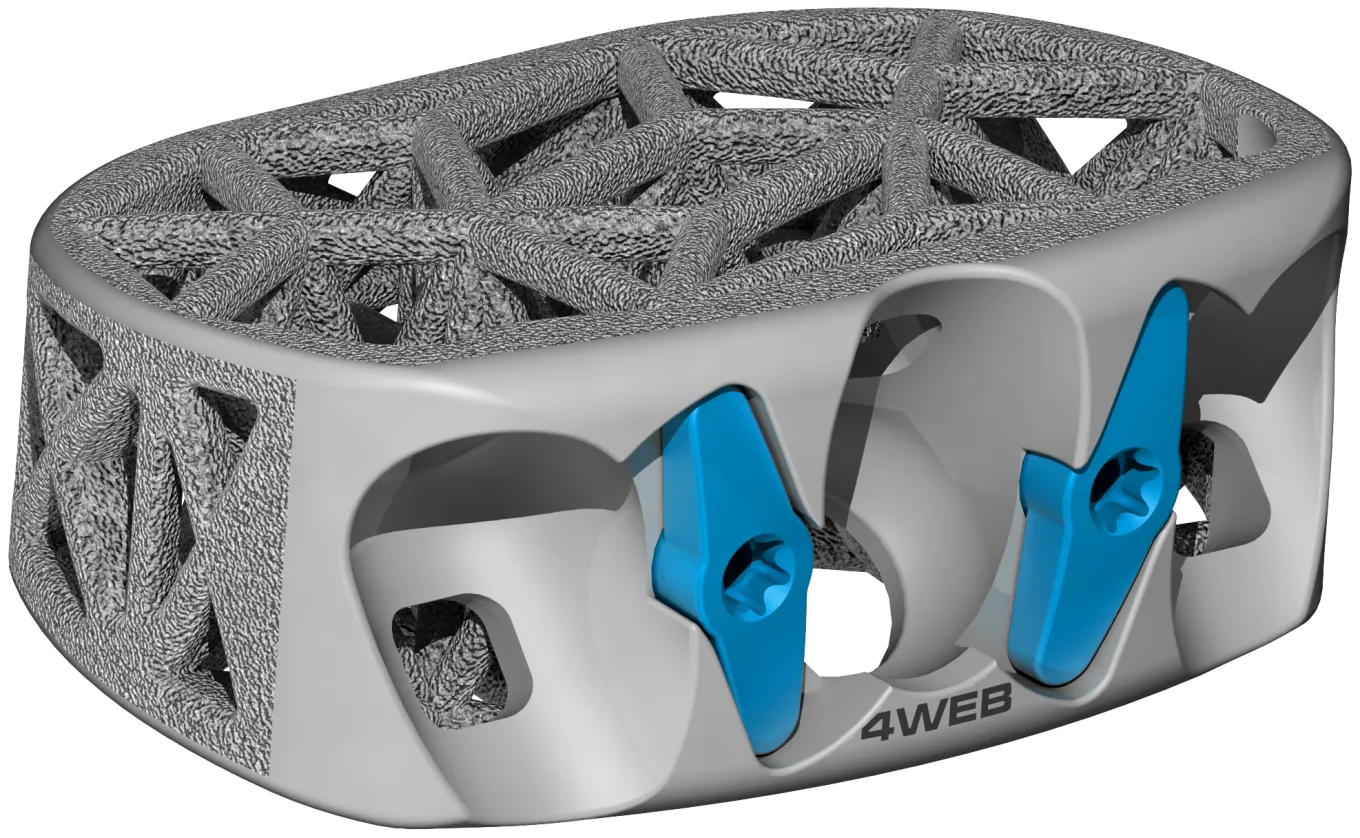 Anterior Spine Truss System – Stand Alone, anchor blocking plate and truss cage
