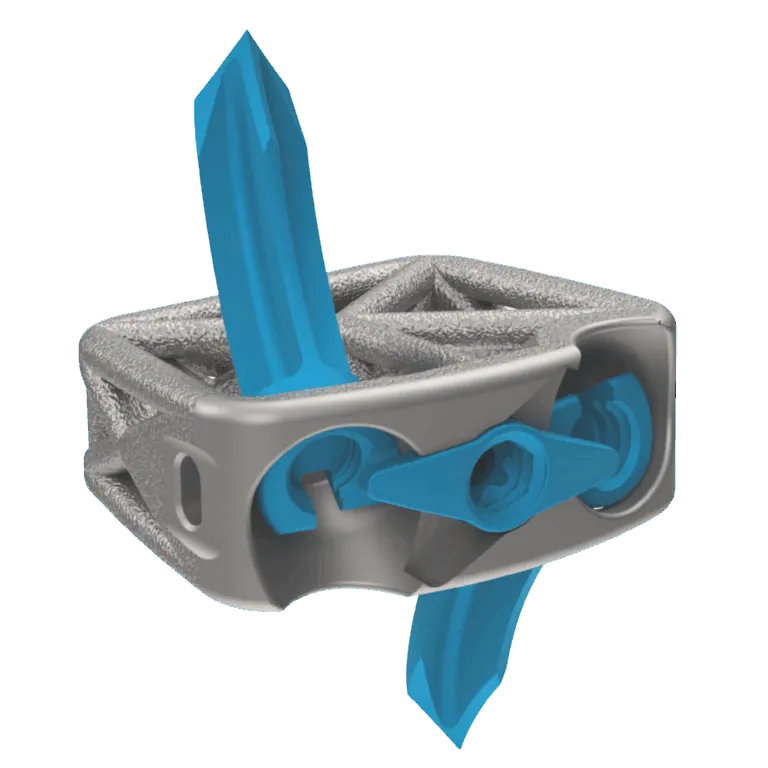 Cervical Spine Truss System™ – Anchor Fixation