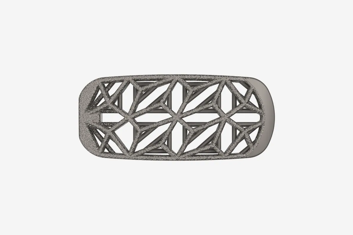 Lateral Spine Truss System top view